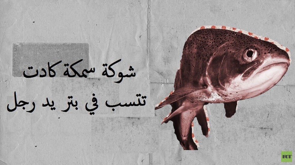 شوكة سمكة كادت تتسبب في بتر يد رجل ستيني (صور + فيديو)