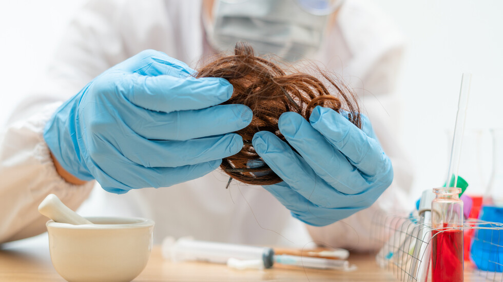 تساقط الشعر يضاف إلى الآثار الجانبية طويلة الأمد لـ