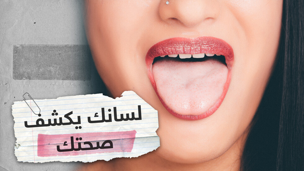 هل لون اللسان يدل على إصابتك بأمراض معينة؟