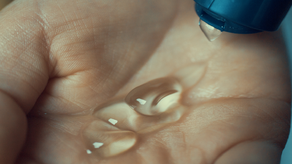 امرأة تصاب بحروق شديدة بعد اشتعال النيران في جلدها بسبب معقم اليدين (صور)