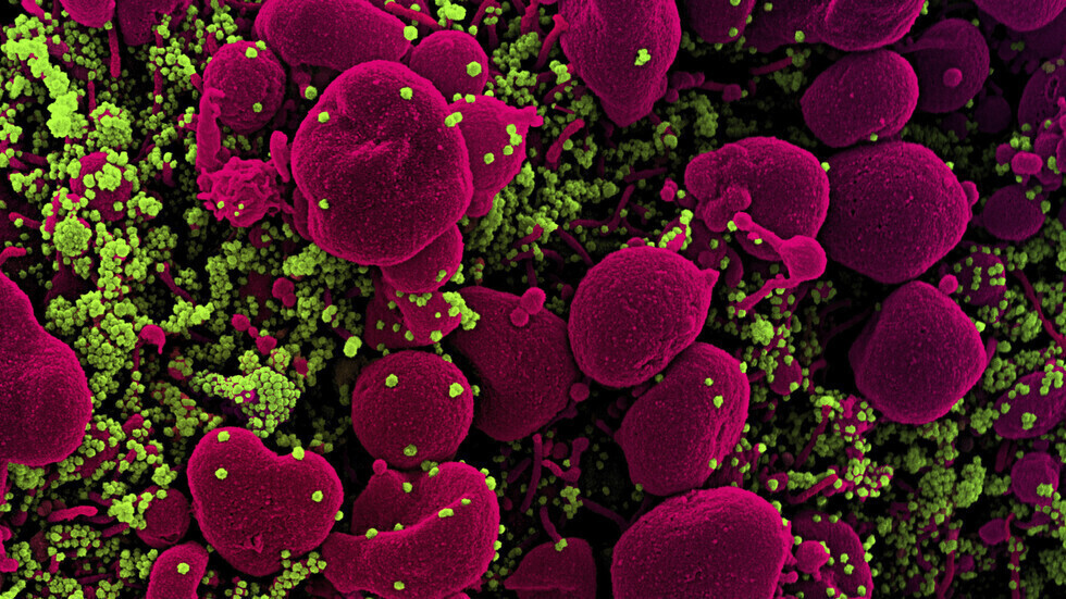 الحالة الشبيهة بمرض كاواساكي المرتبط بـ