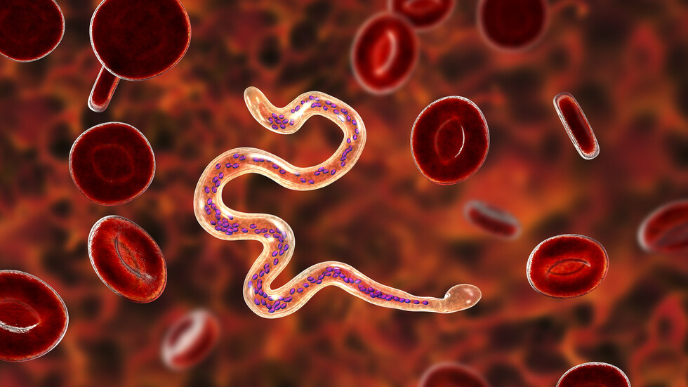 لدغات بعوض تحول ساق رجل إلى 5 أضعاف حجمها الطبيعي ولا علاج لها