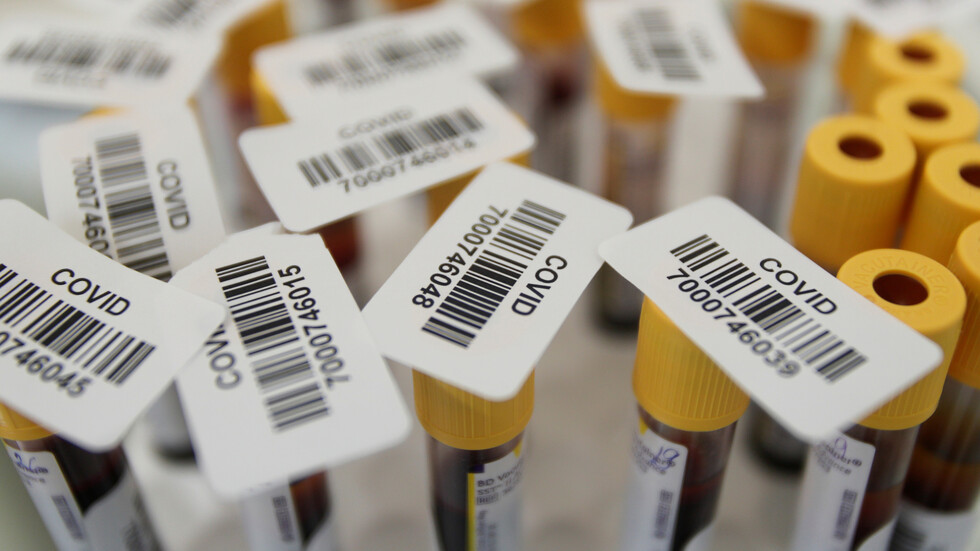 عدد الاختبارات للكشف عن المصابين بكورونا في روسيا يتجاوز 55 مليونا