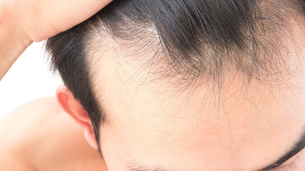 مستخلص طبيعي يزيد من نمو الشعر في أيام بتحفيز بصيلات الشعر