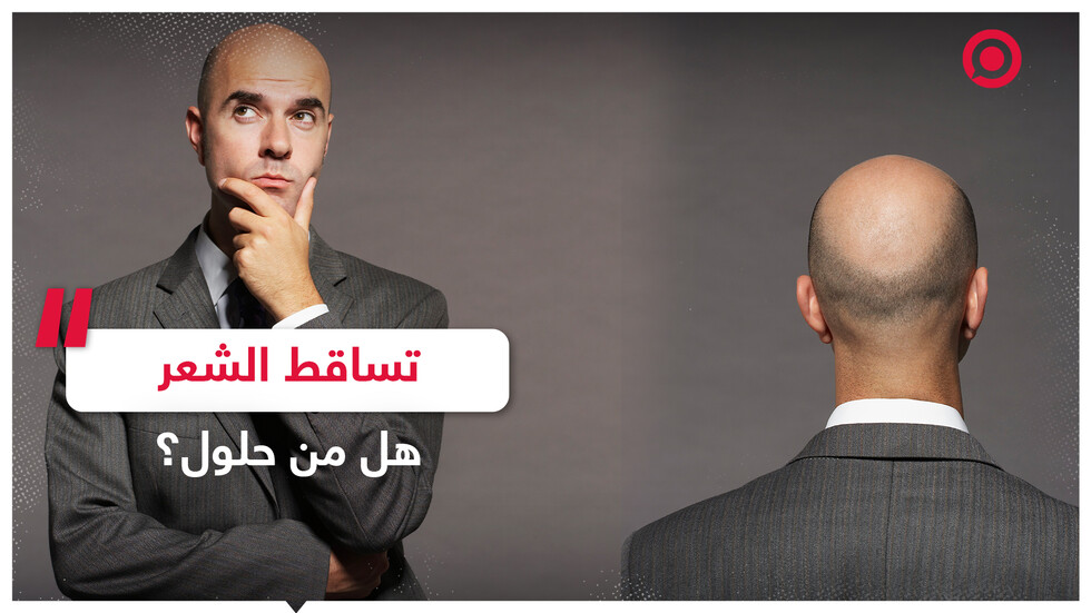 تساقط الشعر..  ما هي الأسباب وأهم سبل الوقاية؟
