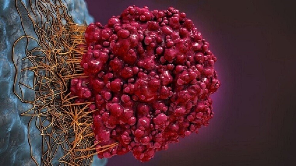 علماء يبتكرون طريقة جديدة لعلاج السرطان يأملون أن تحل مكان العلاج الكيميائي!