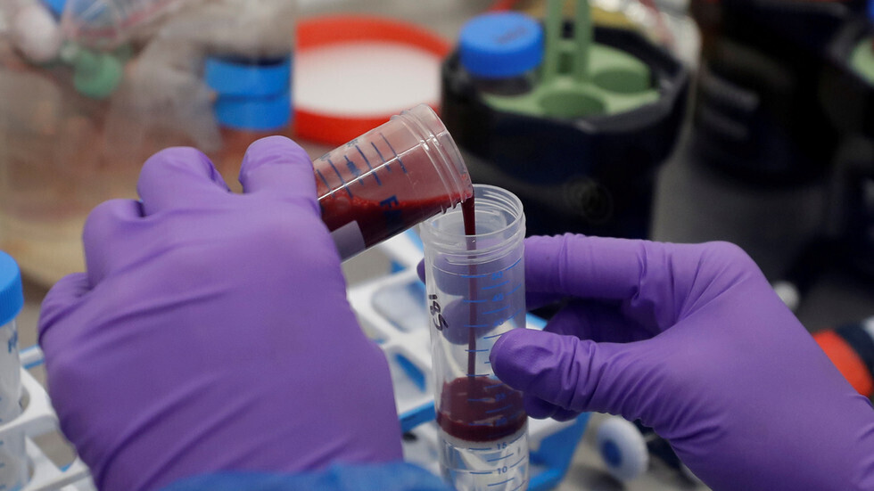 المملكة المتحدة تختبر عقارا شائعا للنقرس كعلاج محتمل لحالات 