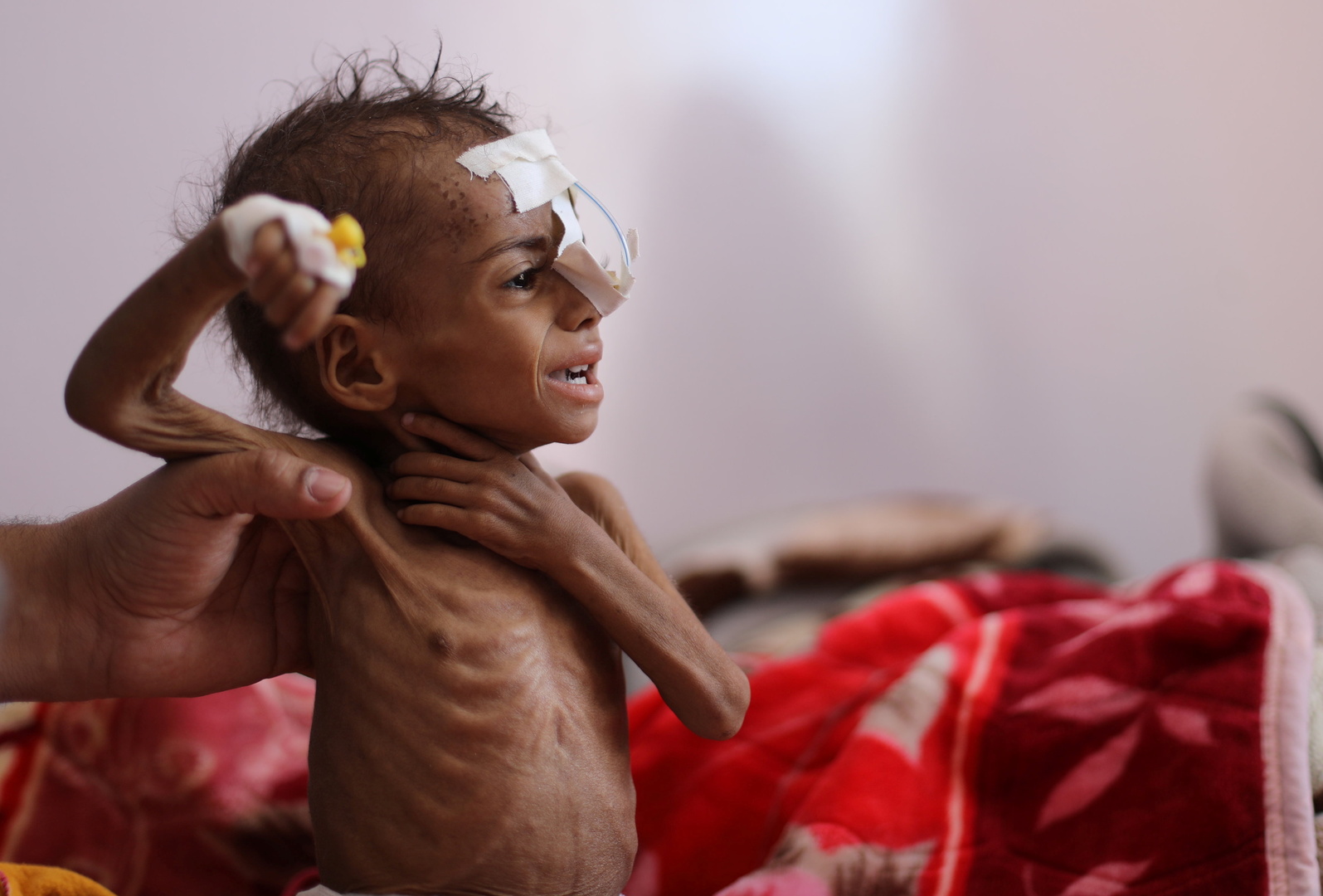 الأمم المتحدة تحذر من مجاعة جديدة تطال الملايين في اليمن