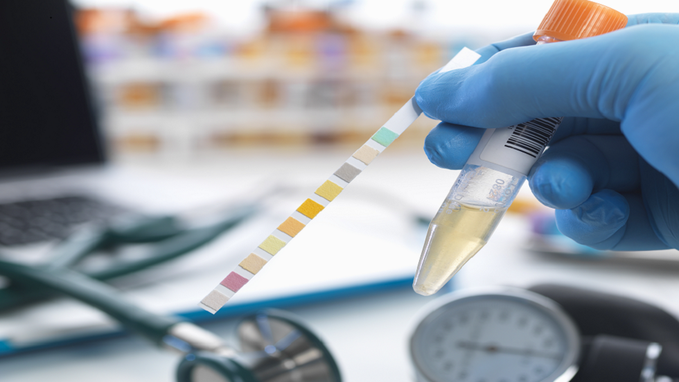 تقرير حالة يفسّر سبب تحول بول مريض إلى اللون الأخضر!