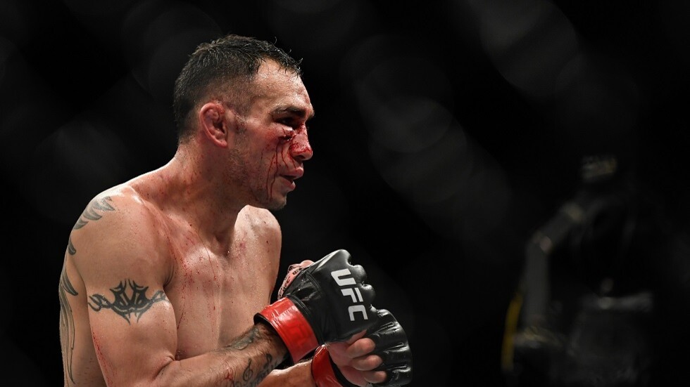 شاهد.. المقاتل الأمريكي "الشرس" فيرغسون في حالة يرثى لها