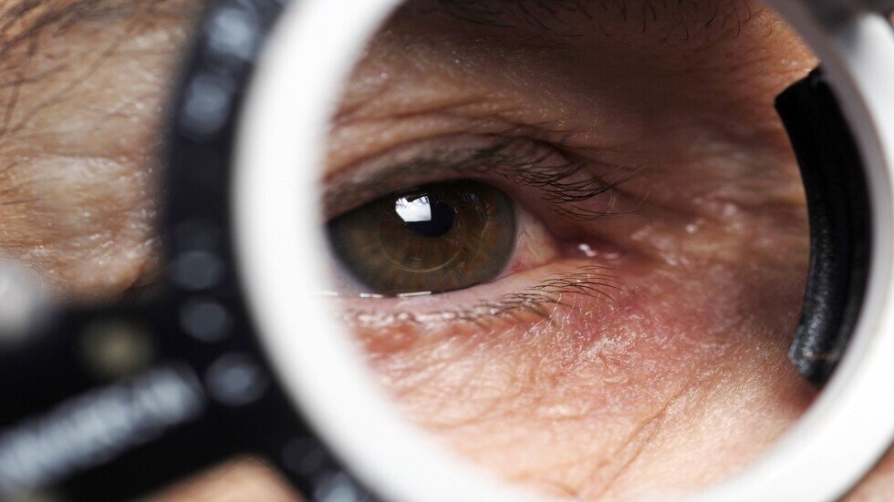 دراسة تقترح العيون الملتهبة من بين أهم أعراض 