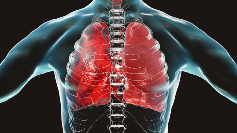 امرأة تعافت من 