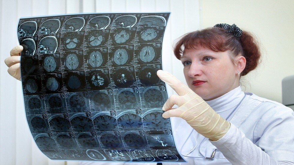 ضعف الذاكرة قد يشير إلى أمراض معينة