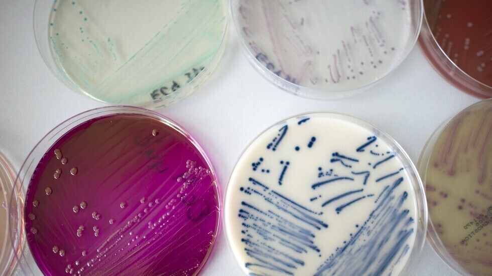 اكتشاف كيفية تطوير بعض البكتيريا مقاومة أكبر للمضادات الحيوية من خلال تغيير شكلها