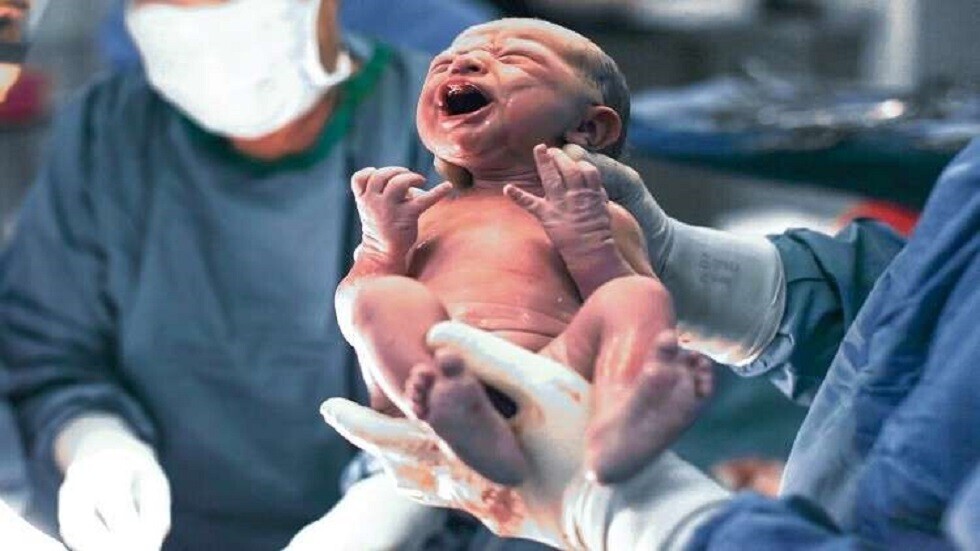 بريق أمل للمولودات دون رحم .. ولادة أول طفل بعد عملية زرع رحم في فرنسا