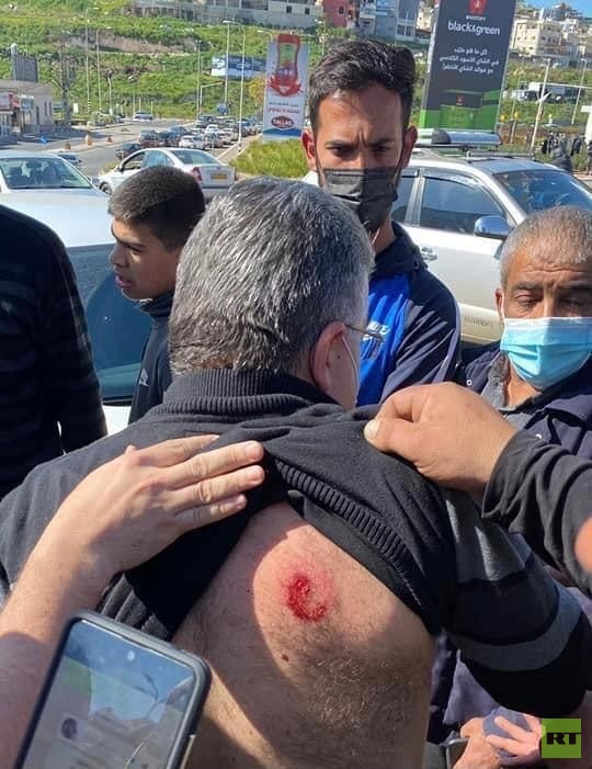 إصابة النائب العربي يوسف جبارين خلال تفريق الشرطة الإسرائيلية تظاهرة في أم الفحم