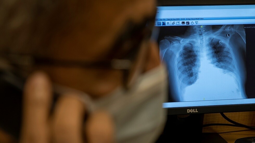 شاب هندي يعود للحياة بعد وضع جثته على طاولة التشريح