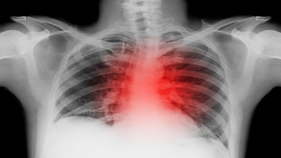 النوبة القلبية: 5 نصائح لتقليل خطر إصابتك بحالة تهدد الحياة!