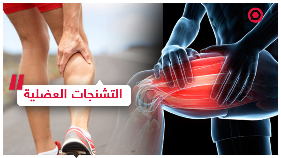 التشنجات العضلية.. ما أسبابها؟