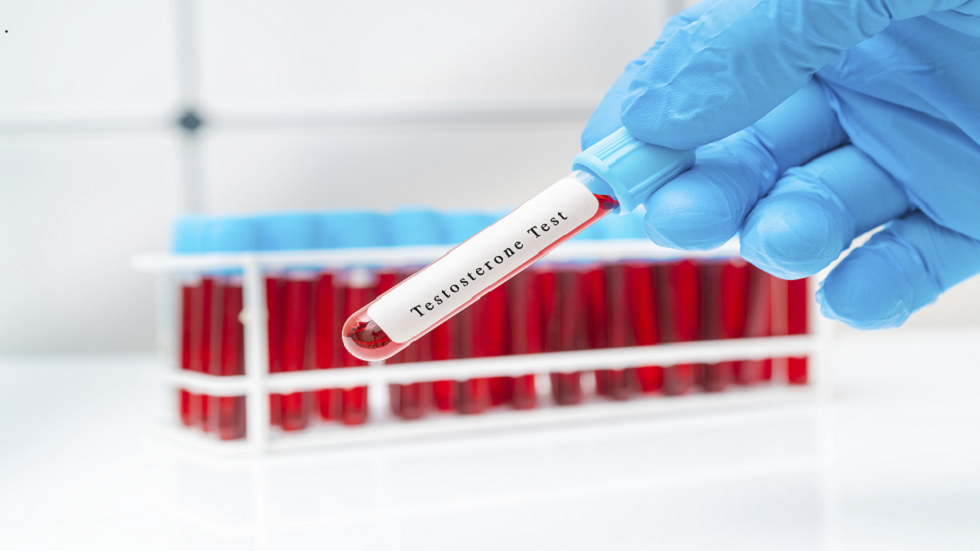 دراسة تحذّر: المستويات العالية من هرمون التستوستيرون لدى الرجال قد تعرضهم لخطر سرطان خبيث!