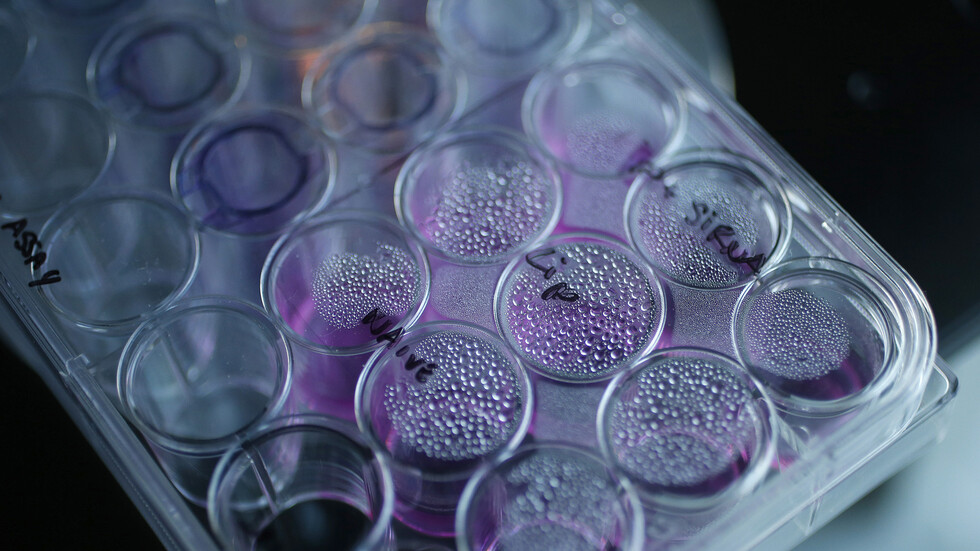 عالم أورام يكشف أعراض حالة ما قبل السرطان