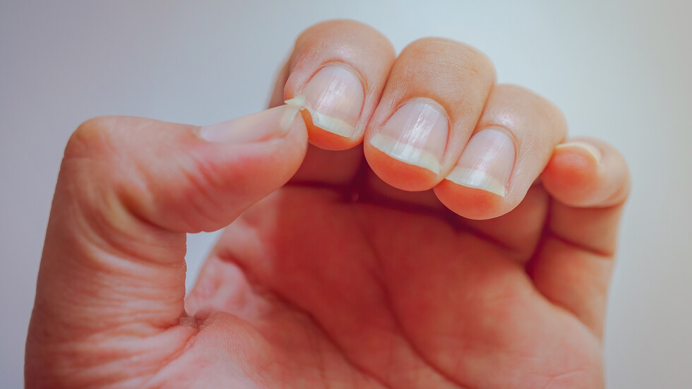 تغيّرات الأظافر تمثل 