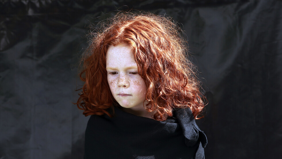 اكتشاف سر ارتفاع الشعور بالألم لدى أصحاب الشعر الأحمر