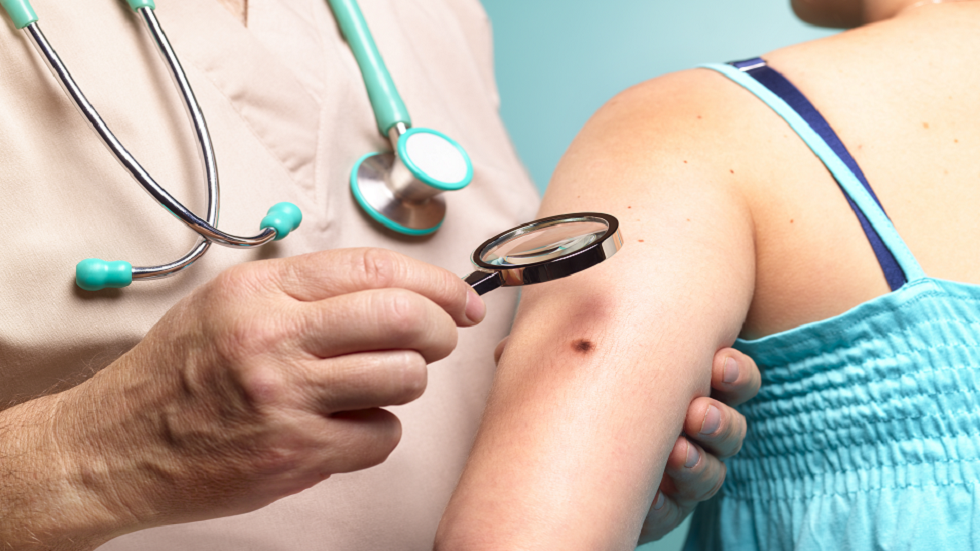 ثلاثة مؤشرات رئيسية على احتمال إصابتك بسرطان الجلد!