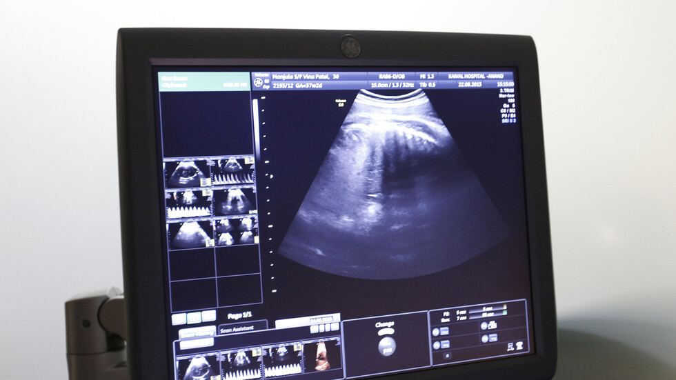 ولاية أيداهو الأمريكية تحظر الإجهاض بعد بدء نبض القلب عند الجنين