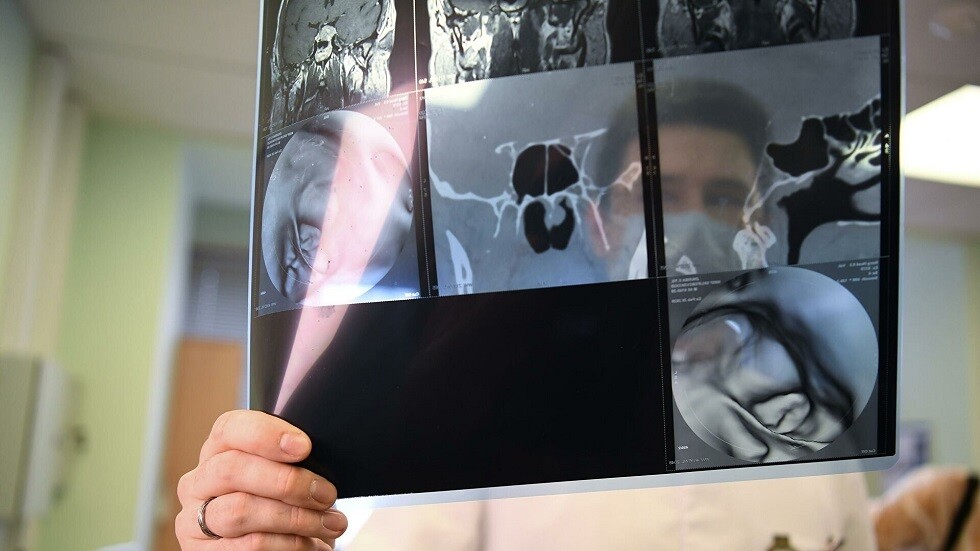 الروس يبتكرون مركّبات فعالة لأدوية مضادة للسرطان