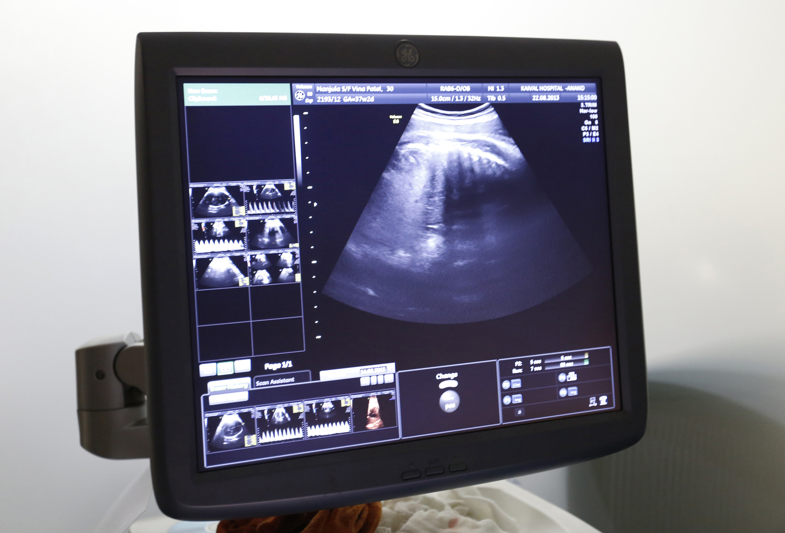ولاية أيداهو الأمريكية تحظر الإجهاض بعد بدء نبض القلب عند الجنين