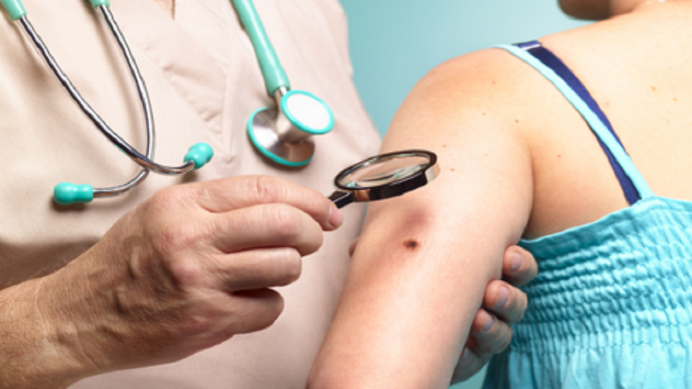 كشف سبب ظهور البقع عند النساء