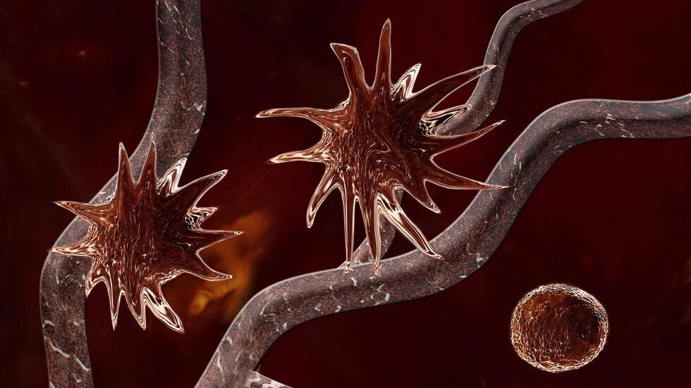 باحثون: تقنية متطورة تجعل أورام السرطان تدمّر نفسها قد تفيد في علاج 