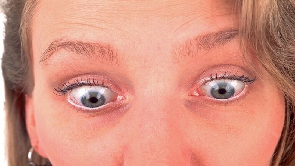 أمراض تشير لها زرقة الجلد تحت العينين