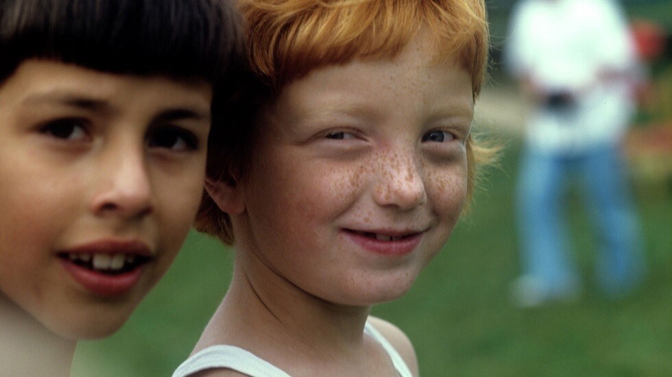 كيف يبدو النمش الخطير؟