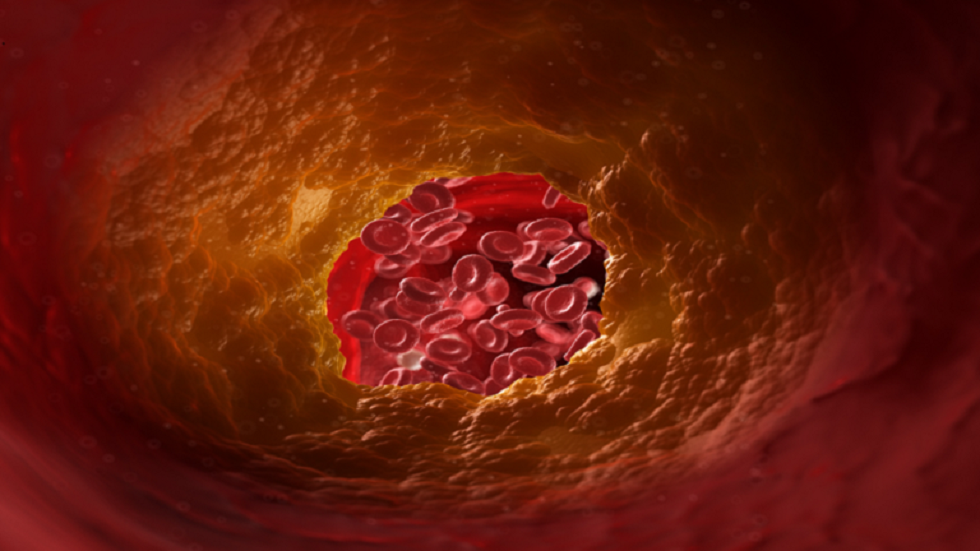 هل تختلف المستويات الصحية للكوليسترول حسب العمر؟!