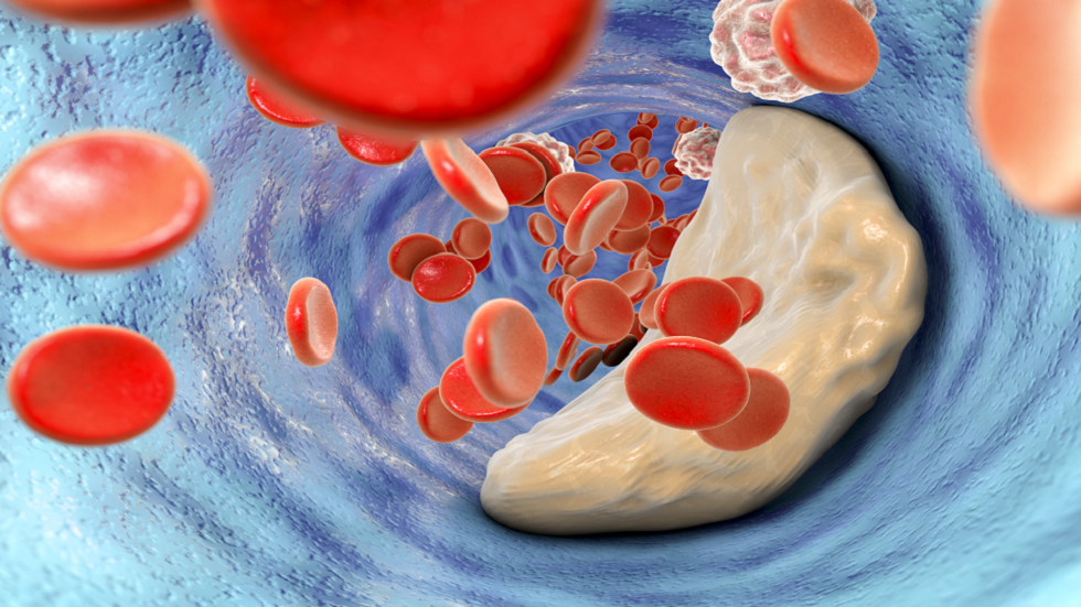 مشروبات غذائية ثبت أنها تساعد في خفض الكوليسترول وتجنب المخاطر الجسيمة!