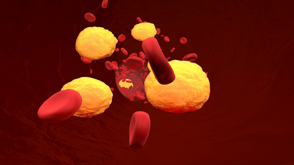 علامة خفية في أصابعك قد تدل على ارتفاع مستويات الكوليسترول!