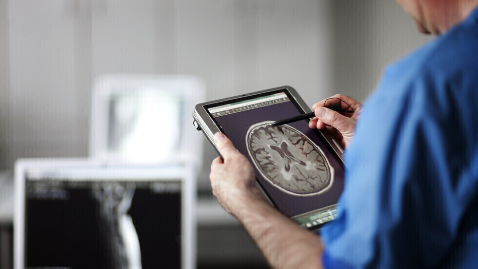 لماذا يمكن أن تؤثر السكتات الدماغية على النساء والرجال بشكل مختلف؟