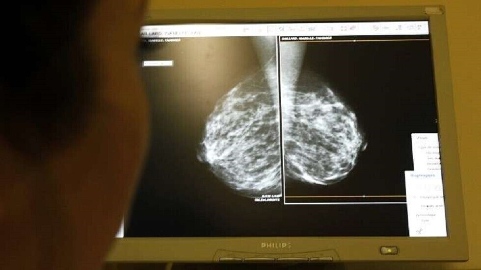 مواد كيميائية في المنتجات الاستهلاكية قد تزيد من خطر الإصابة بسرطان الثدي