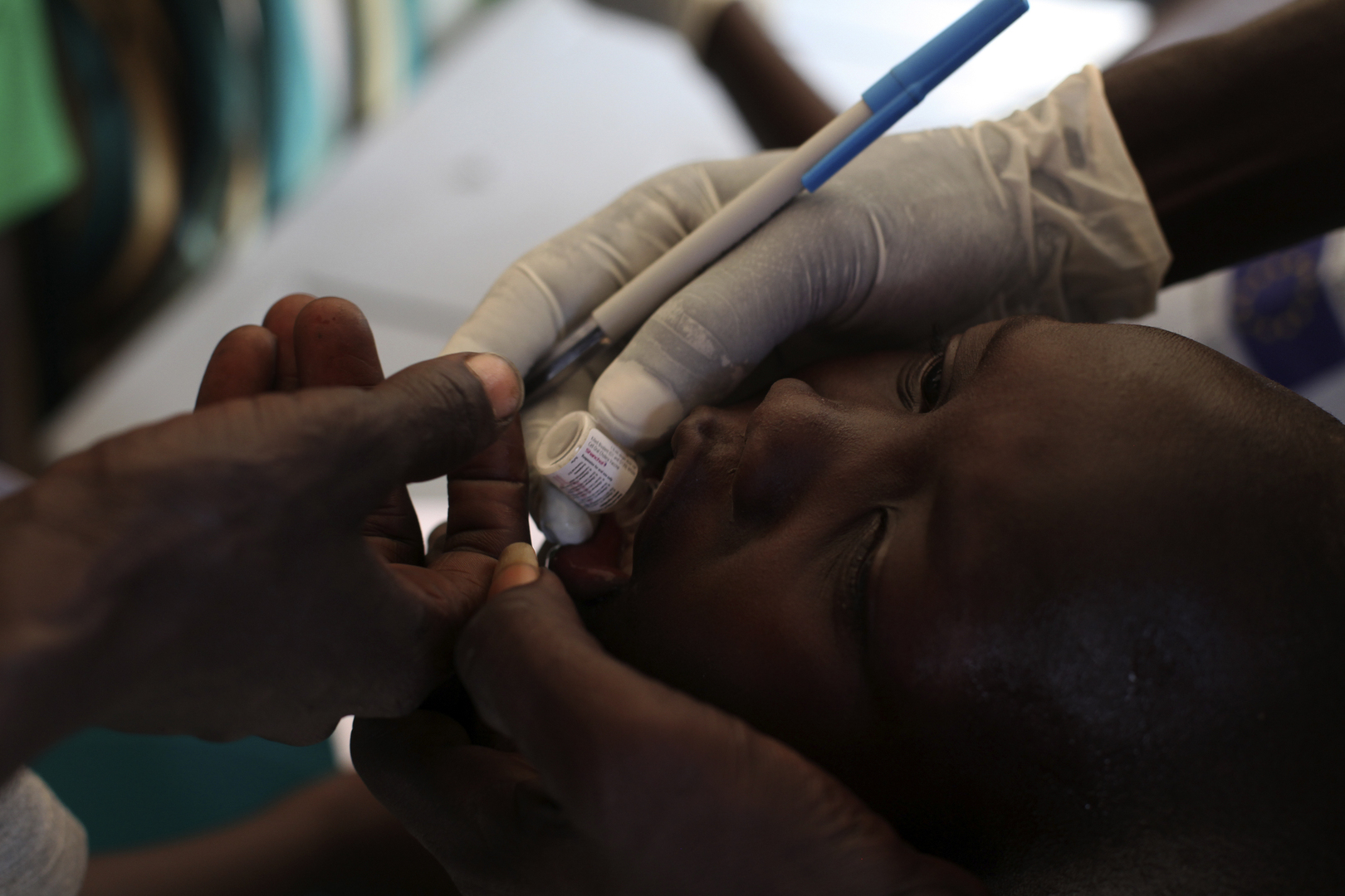 السودان..مستشار حمدوك الصحي السابق يدق جرس إنذار استعدادا لوبائيات الكوليرا والملاريا والحمى النزفية