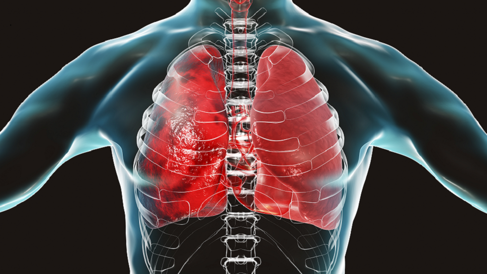 صور الأشعة السينية تكشف تأثر التطعيم من عدمه على الرئتين لدى مرضى "كوفيد-19"