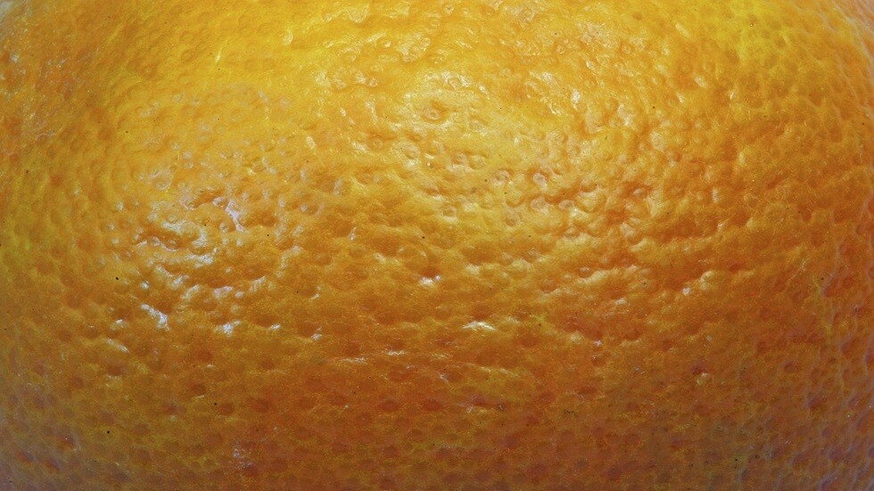 مواد غذائية تسبب السيلوليت