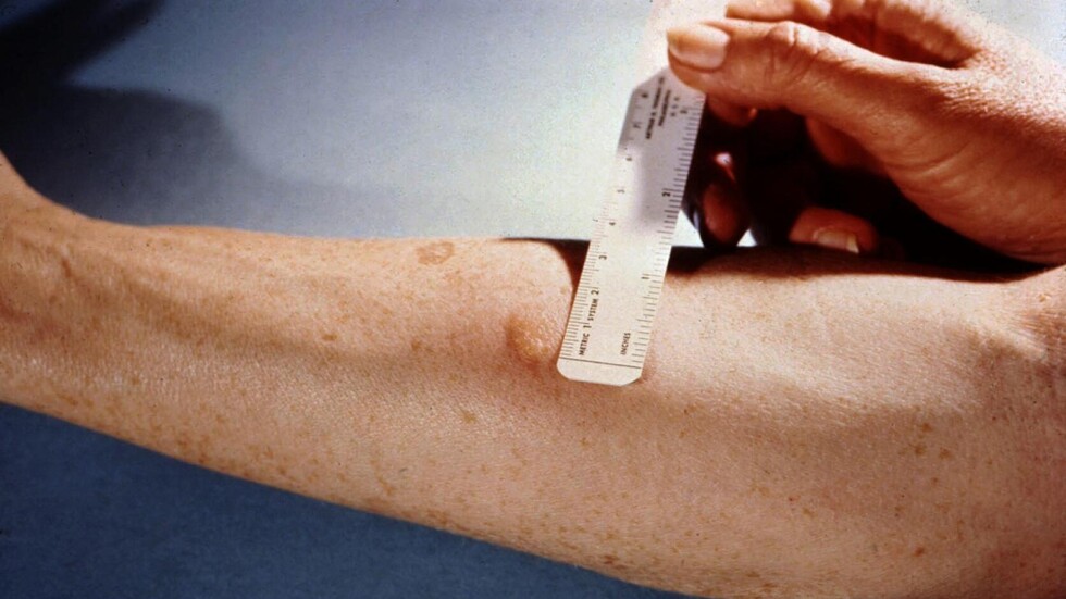 اكتشاف مذهل..  التطور في جسم الإنسان متواصل وهذا هو الدليل