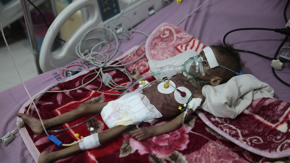 الأمم المتحدة: 16 مليون يمني يسيرون نحو المجاعة