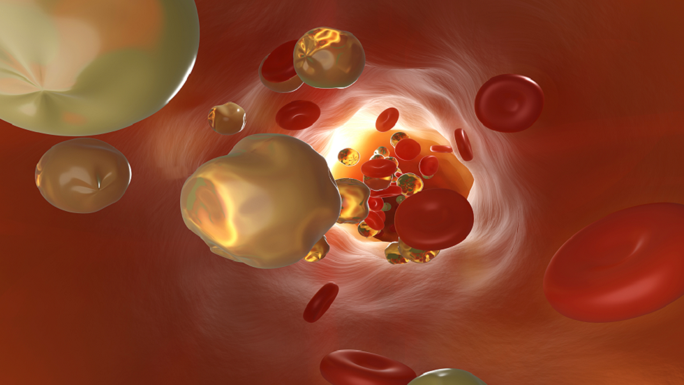 خمس وجبات خفيفة لتقليل خطر أعراض ارتفاع الكوليسترول