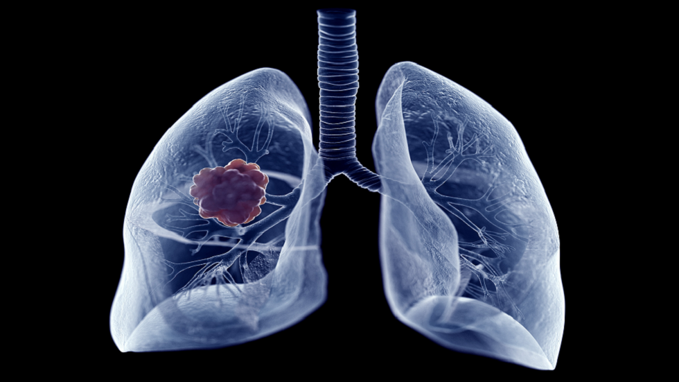 اختراق السرطان مع 