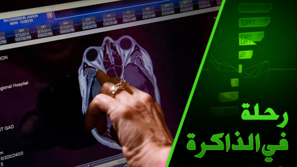 مجرد نفسية أم اضطراب شخصية؟ أحد كبار علماء الطب النفسي يوضح الفرق بين الاضطرابات والحالات المرضية