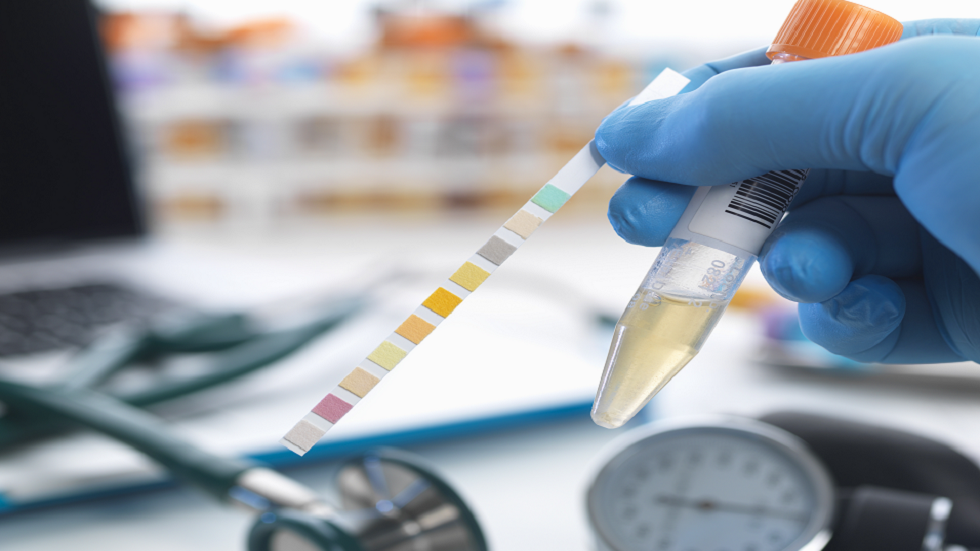 علامة في البول تحذر من احتمال الإصابة بـ 