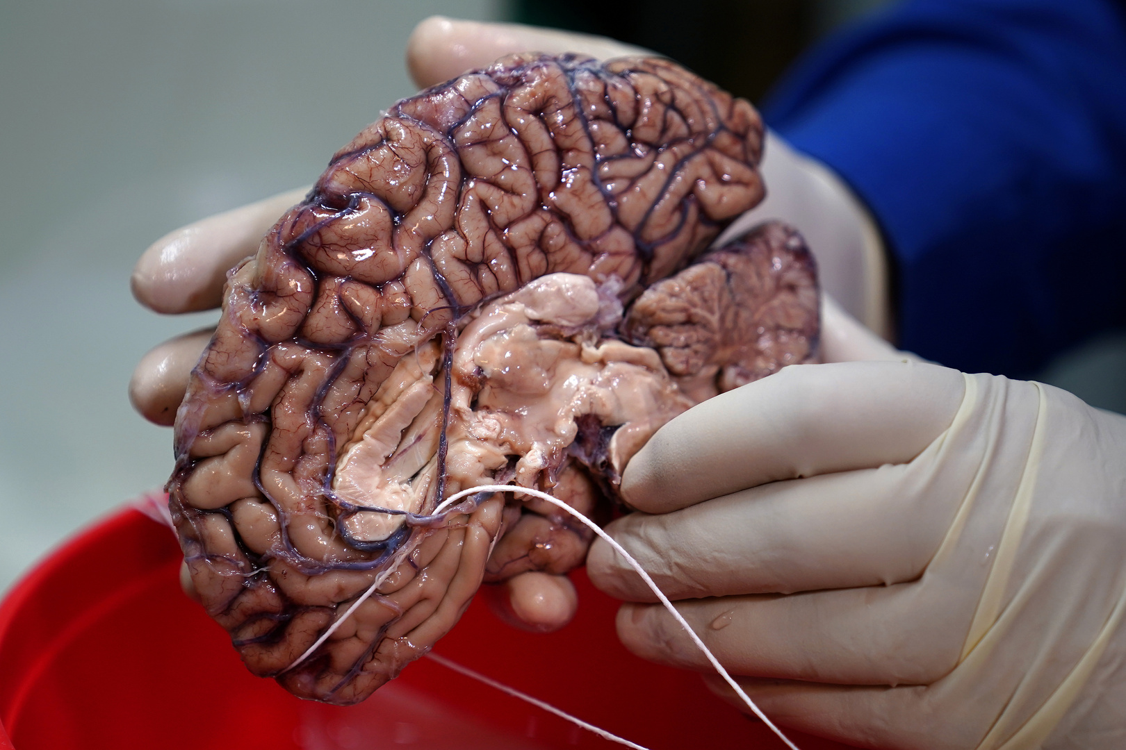 عالم روسي يكشف طرقا لإبطاء شيخوخة دماغ الإنسان